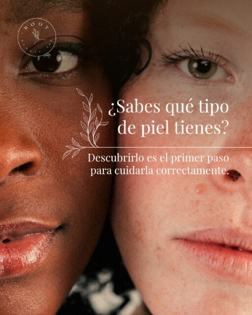 🌿¿Sabías que conocer tu tipo de piel es uno de los pasos más importantes para conseguir una piel sana y cuidada? 🧖🏽‍♀️

Muchas veces invertimos en productos, tratamientos o rutinas sin saber realmente qué necesita nuestra piel. Sin embargo, una piel grasa no requiere los mismos cuidados que una piel seca, sensible o mixta. Identificar correctamente sus características permite tomar mejores decisiones y obtener resultados más efectivos 🤍

👉🏽 En Root Beauty Lab creemos que cada piel es única. Por eso, ofrecemos un asesoramiento personalizado para ayudarte a conocer tu piel en profundidad y diseñar una rutina adaptada a sus necesidades reales. 

✨ Desliza para descubrir qué tipo de piel se parece más a la tuya y empieza a cuidarla de la forma que merece.

Te esperamos en: 

📍C/ Alemania 78, Las Palmas de Gran Canaria 

📞608 900 350 • Lun-Vie 11:00-19:00

🗓️Reserva en el enlace de la bio 

#SoyRoot #MetodoRoot #BellezaConRaíz #TiposDePiel #CuidadoDeLaPiel #Skincare #PielSana #RutinaFacial #EsteticaAvanzada #RootBeautyLab